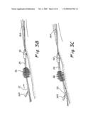 VALVED CONNECTOR ASSEMBLY AND STERILITY BARRIERS FOR HEAT EXCHANGE CATHETERS AND OTHER CLOSED LOOP CATHETERS diagram and image