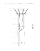 APPARATUS FOR MAGNETICALLY DEPLOYABLE CATHETER WITH MOSFET SENSOR AND METHOD FOR MAPPING AND ABLATION diagram and image