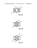 Method for the treatment of gallstones diagram and image