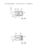 Method for the treatment of gallstones diagram and image