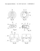 Method for the treatment of gallstones diagram and image