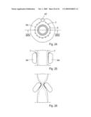 Method for the treatment of gallstones diagram and image