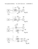 Method for the treatment of gallstones diagram and image