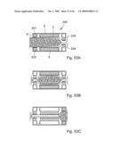 Method for the treatment of gallstones diagram and image