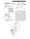 METHOD AND SYSTEM FOR PLANNING/GUIDING ALTERATIONS TO A BONE diagram and image