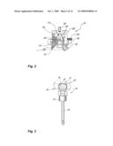 METHOD AND SYSTEM FOR PLANNING/GUIDING ALTERATIONS TO A BONE diagram and image