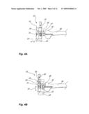 METHOD AND SYSTEM FOR PLANNING/GUIDING ALTERATIONS TO A BONE diagram and image