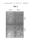 INHIBITION OF INFLAMMATORY CYTOKINE PRODUCTION BY CHOLINERGIC AGONISTS AND VAGUS NERVE STIMULATION diagram and image