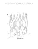 STENT WITH POLISHED EYELET diagram and image