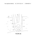 STENT WITH POLISHED EYELET diagram and image