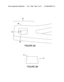 STENT WITH POLISHED EYELET diagram and image