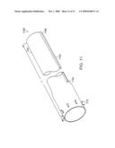 Bariatric sleeve diagram and image