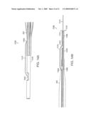 Bariatric sleeve diagram and image