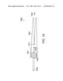 Bariatric sleeve diagram and image