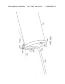 Bariatric sleeve diagram and image