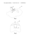 Nasal interface device diagram and image