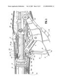 SURGICAL STAPLING DEVICE diagram and image