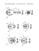 SURGICAL STAPLING DEVICE diagram and image