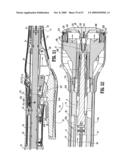 SURGICAL STAPLING DEVICE diagram and image