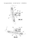 SURGICAL STAPLING DEVICE diagram and image