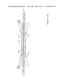 CLADDING PUMPED FIBRE LASER WITH A HIGH DEGREE OF PUMP ISOLATION diagram and image