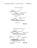METHOD AND APPARATUS FOR PATIENT LOADING AND UNLOADING diagram and image