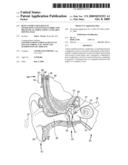 BONE CONDUCTION DEVICES GENERATING TANGENTIALLY-DIRECTED MECHANICAL FORCE USING A LINEARLY MOVING MASS diagram and image