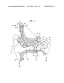 BONE CONDUCTION DEVICES GENERATING TANGENTIALLY-DIRECTED MECHANICAL FORCE USING A LINEARLY MOVING MASS diagram and image