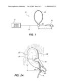 Ear Phone/Bud Lanyard diagram and image