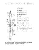 Ribbon transducer with improved dispersion, excursion and distortion characteristics diagram and image