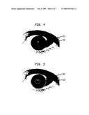 SEGMENTATION OF IRIS IMAGES USING ACTIVE CONTOUR PROCESSING diagram and image