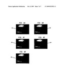 SEGMENTATION OF IRIS IMAGES USING ACTIVE CONTOUR PROCESSING diagram and image