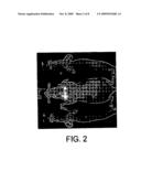 IN-VIVO OPTICAL IMAGING METHOD INCLUDING ANALYSIS OF DYNAMIC IMAGES diagram and image