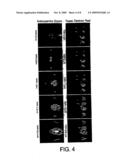 IN-VIVO OPTICAL IMAGING METHOD INCLUDING ANALYSIS OF DYNAMIC IMAGES diagram and image