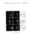 IN-VIVO OPTICAL IMAGING METHOD INCLUDING ANALYSIS OF DYNAMIC IMAGES diagram and image