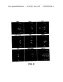 IN-VIVO OPTICAL IMAGING METHOD INCLUDING ANALYSIS OF DYNAMIC IMAGES diagram and image