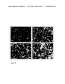 Antibodies Against Amyloid Beta 4 With Glycosylated in the Variable Region diagram and image