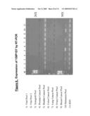 NUCLEIC ACID AND CORRESPONDING PROTEIN NAMED 158P1D7 USEFUL IN THE TREATMENT AND DETECTION OF BLADDER AND OTHER CANCERS diagram and image