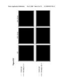 NUCLEIC ACID AND CORRESPONDING PROTEIN NAMED 158P1D7 USEFUL IN THE TREATMENT AND DETECTION OF BLADDER AND OTHER CANCERS diagram and image