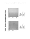 NUCLEIC ACIDS AND CORRESPONDING PROTEINS ENTITLED 282P1G3 USEFUL IN TREATMENT AND DETECTION OF CANCER diagram and image