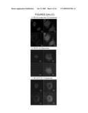 ENDOPLASMIC RETICULUM TARGETING LIPOSOMES diagram and image