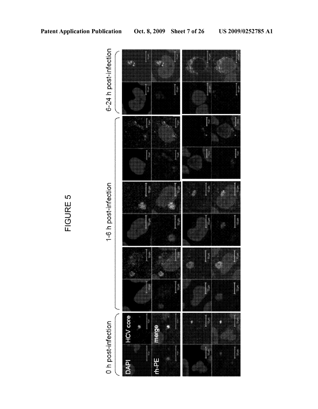 ENDOPLASMIC RETICULUM TARGETING LIPOSOMES - diagram, schematic, and image 08