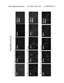 ENDOPLASMIC RETICULUM TARGETING LIPOSOMES diagram and image