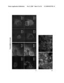 ENDOPLASMIC RETICULUM TARGETING LIPOSOMES diagram and image