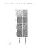 Combined treatment with radiation and an epidermal growth factor receptor kinase inhibitor diagram and image