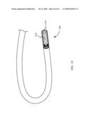 LIQUID LIGHT-GUIDE CATHETER WITH OPTICALLY DIVERGING TIP diagram and image