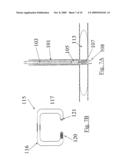 Suturing Device for Anastomisis of Lumens diagram and image