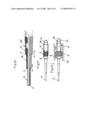 Catheter device diagram and image