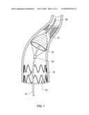 RETRIEVAL CATHETER AND METHODS OF RETRIEVING DEPLOYED MEDICAL DEVICES diagram and image