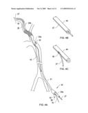 RETRIEVAL CATHETER AND METHODS OF RETRIEVING DEPLOYED MEDICAL DEVICES diagram and image